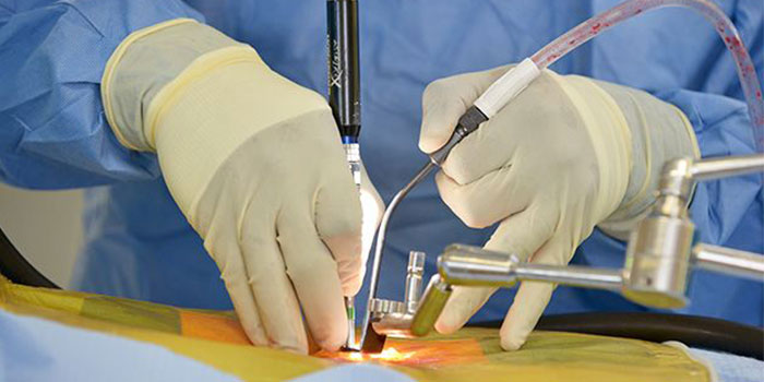 minimally invasive spine surgery in surat, gujarat